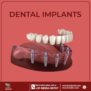 FMS Dental Center Kochi media 7