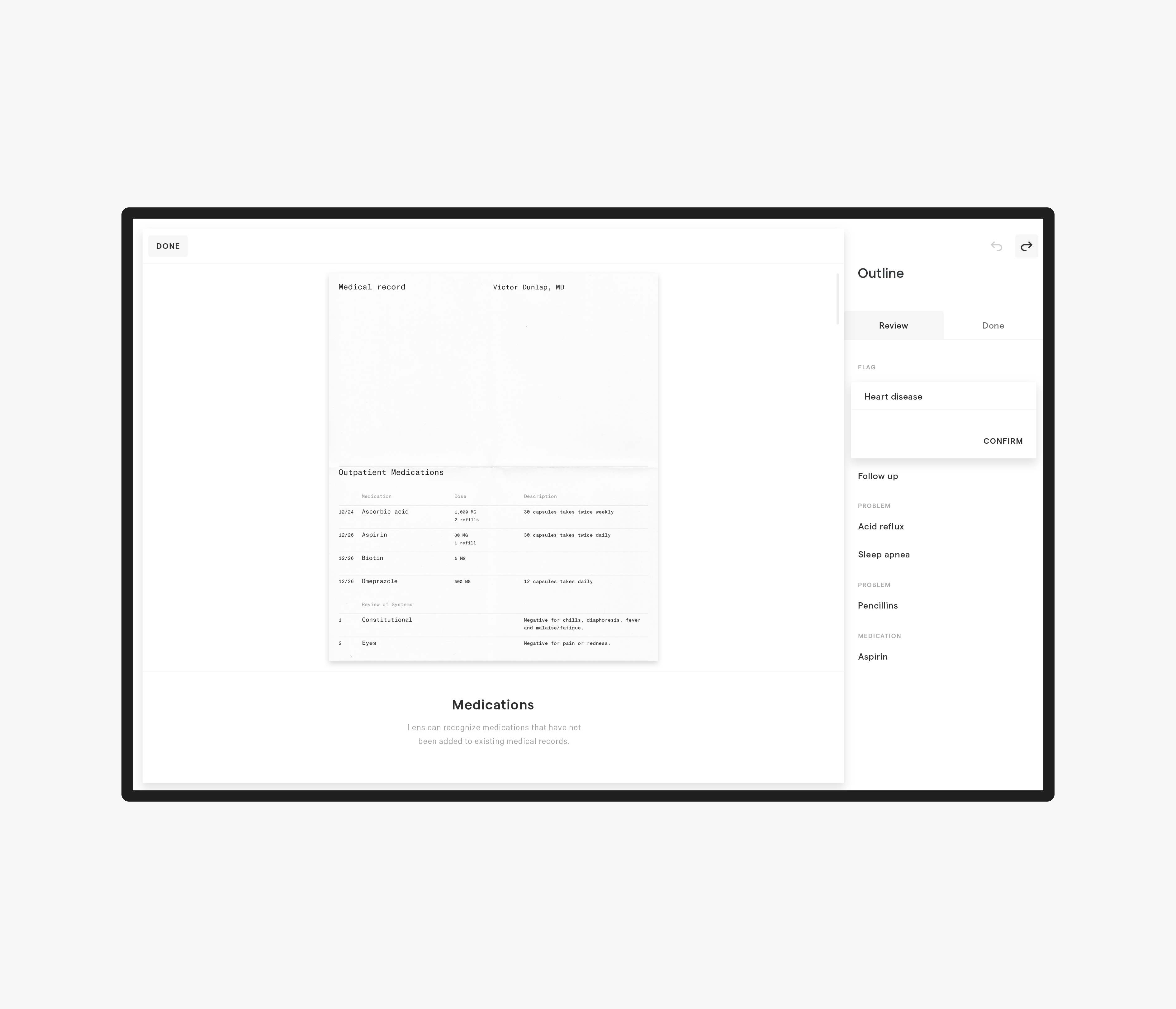 Lens by Science gallery image