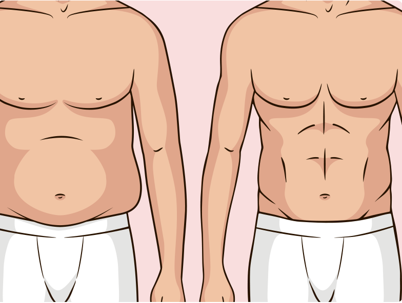 Liposuction in Lahore