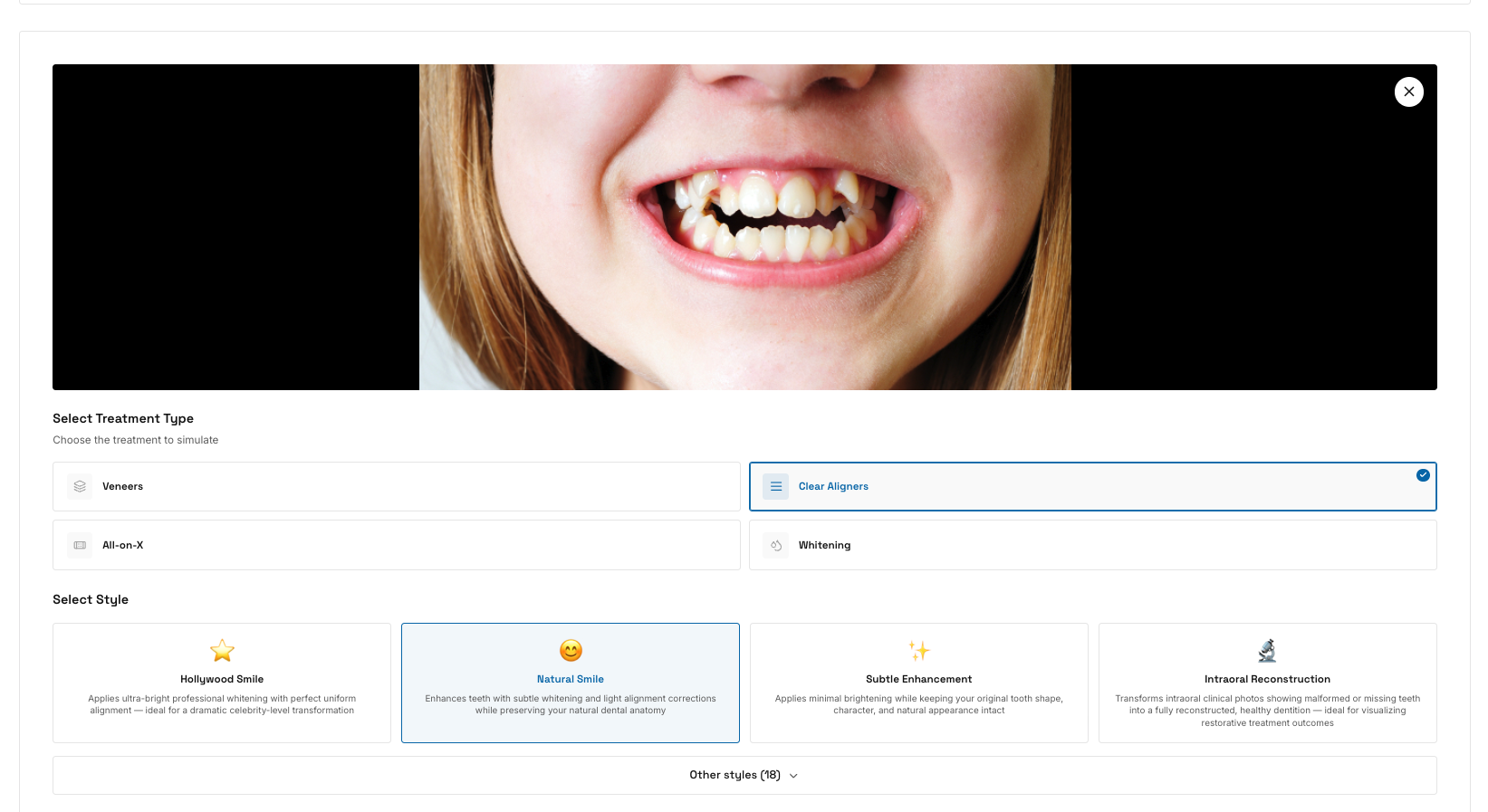 SmilePro AI Simulation for Dentists gallery image
