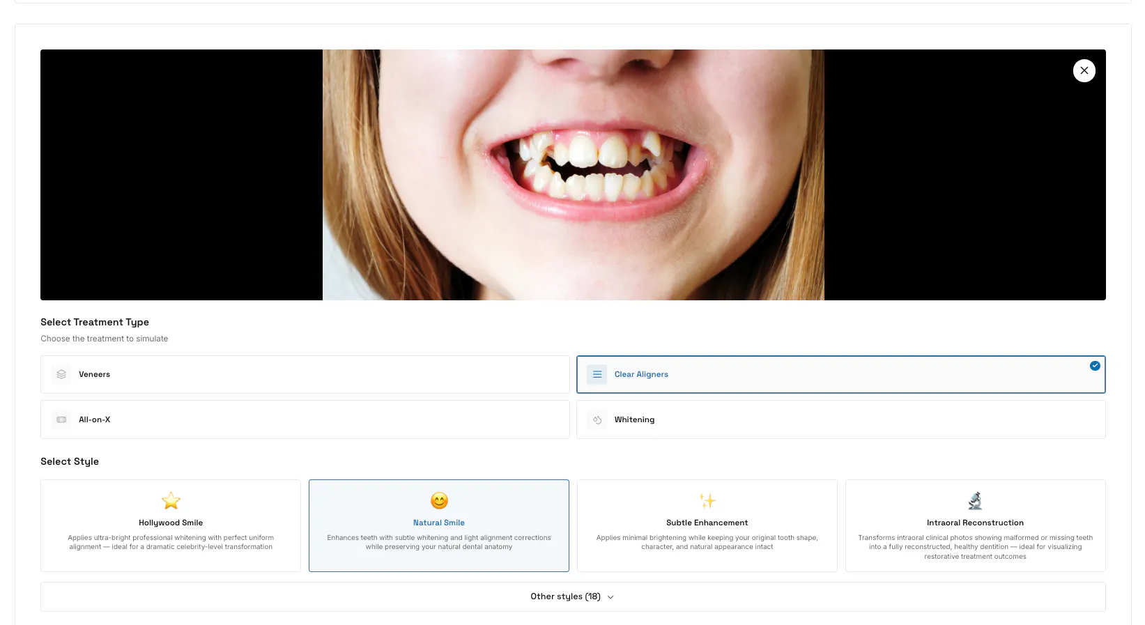 SmilePro AI Simulation for Dentists 제품 배너