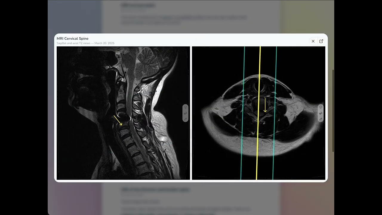 The Interactive Radiology Report gallery image