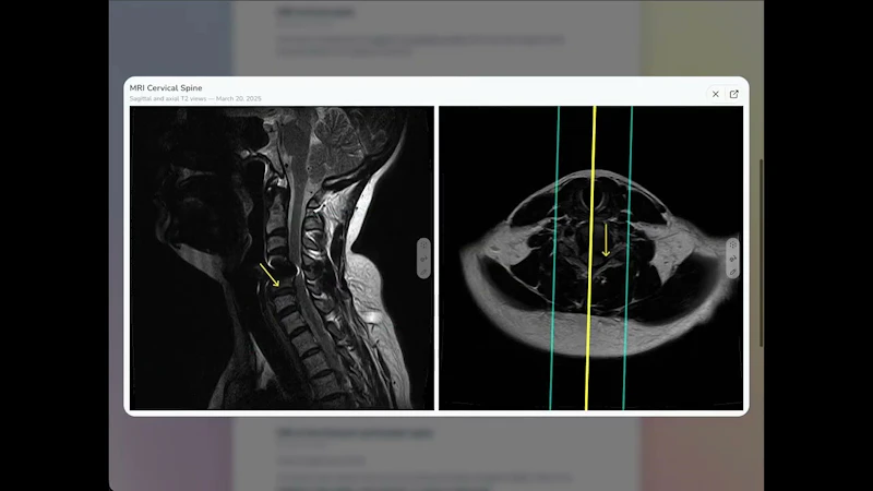 The Interactive Radiology Report screenshot 1 (video preview)