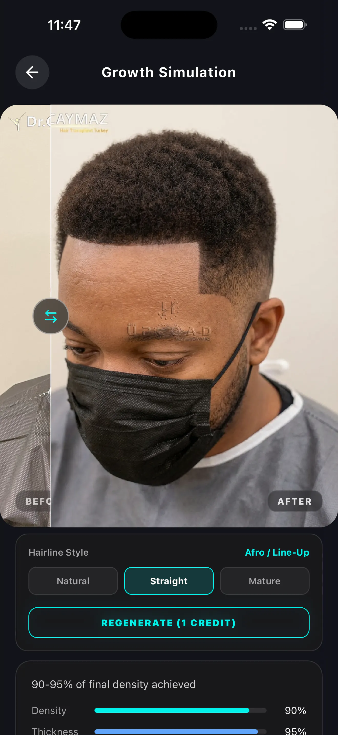 HairArchitect: AI Transplant gallery image