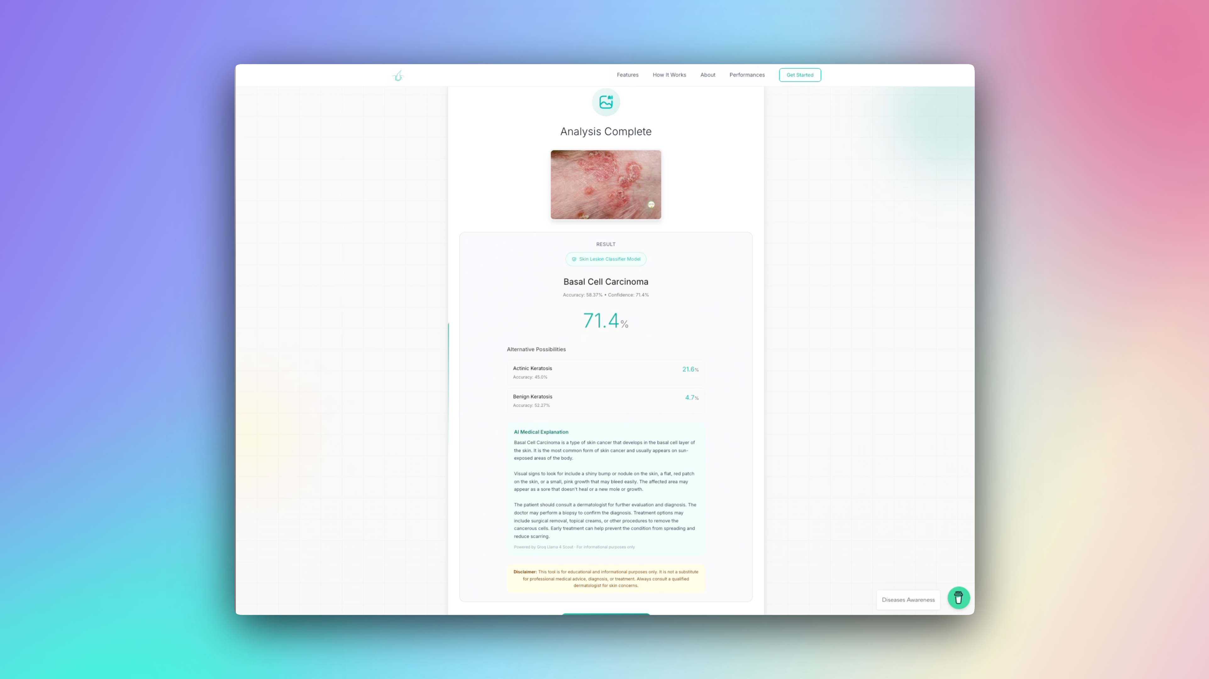 Skin Disease Identification gallery image