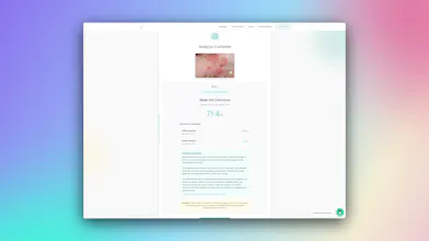 Skin Disease Identification gallery image