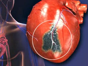 Heart Health Test gallery image