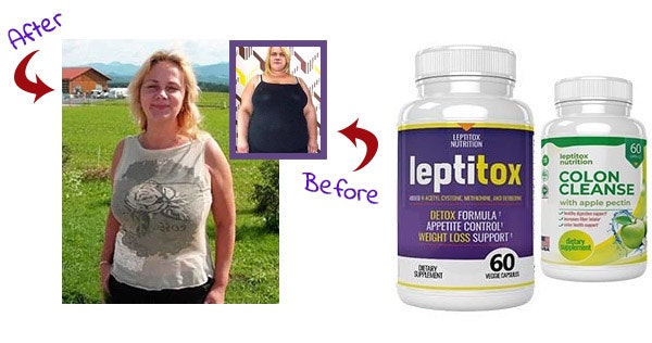 Leptitox Dietary Supplement gallery image