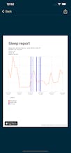 Sleep Monitoring 2 gallery image