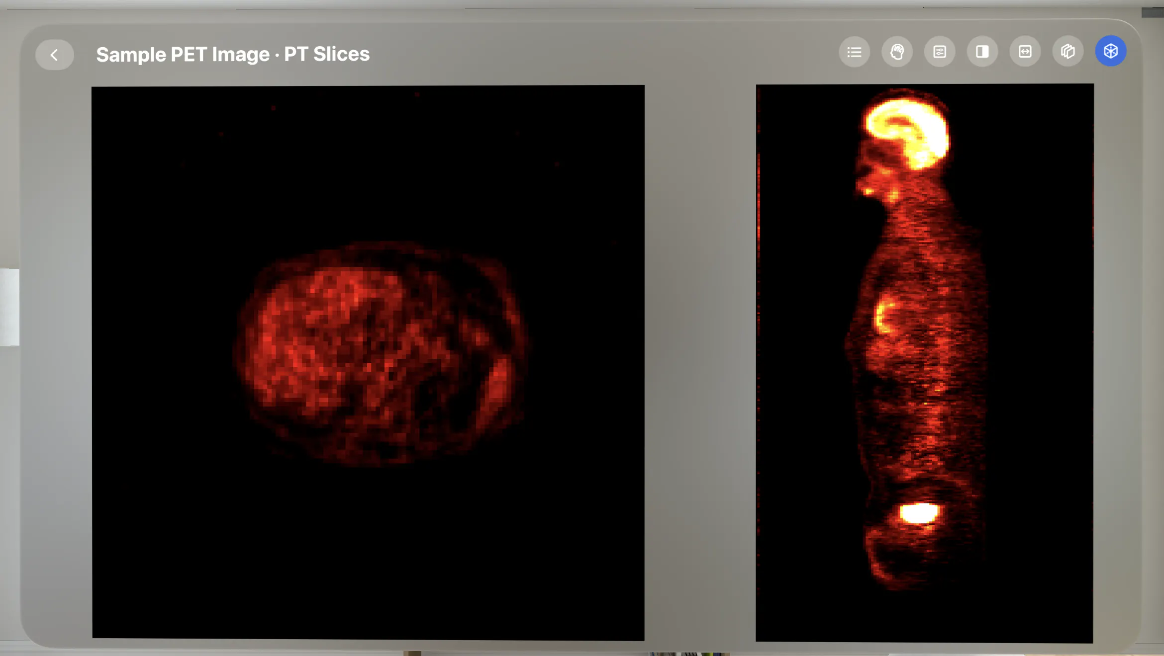 VoxelVision - DICOM Viewer gallery image
