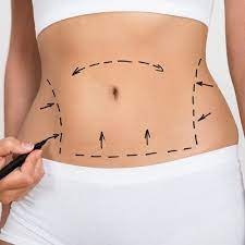 迪拜的Velashape 3治疗媒体1