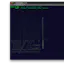 Advent of Code