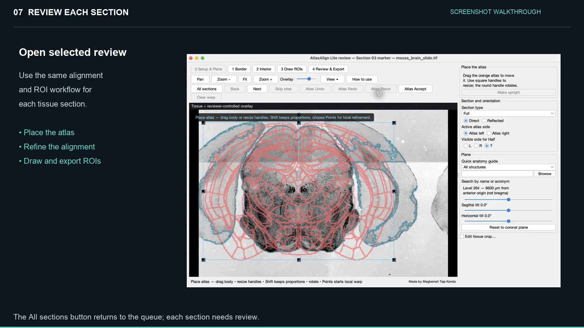 AtlasAlign gallery image