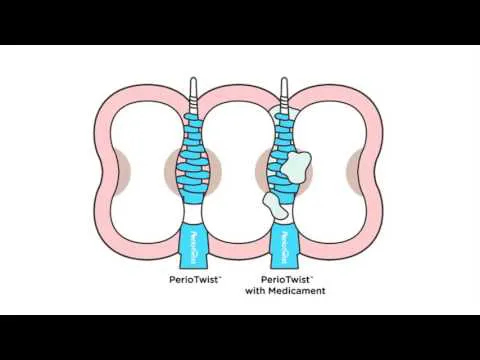 PerioTwist - A future without Flossing