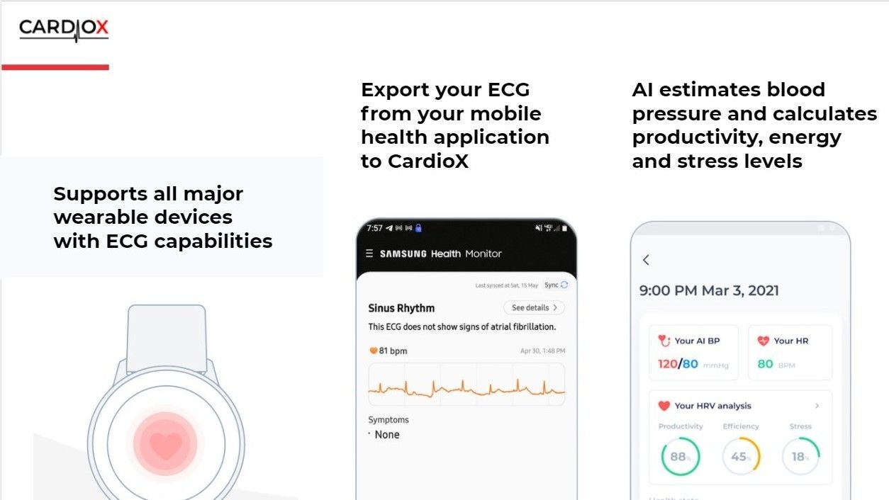 CardioX gallery image
