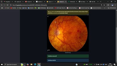 Diabetic Retinopathy gallery image