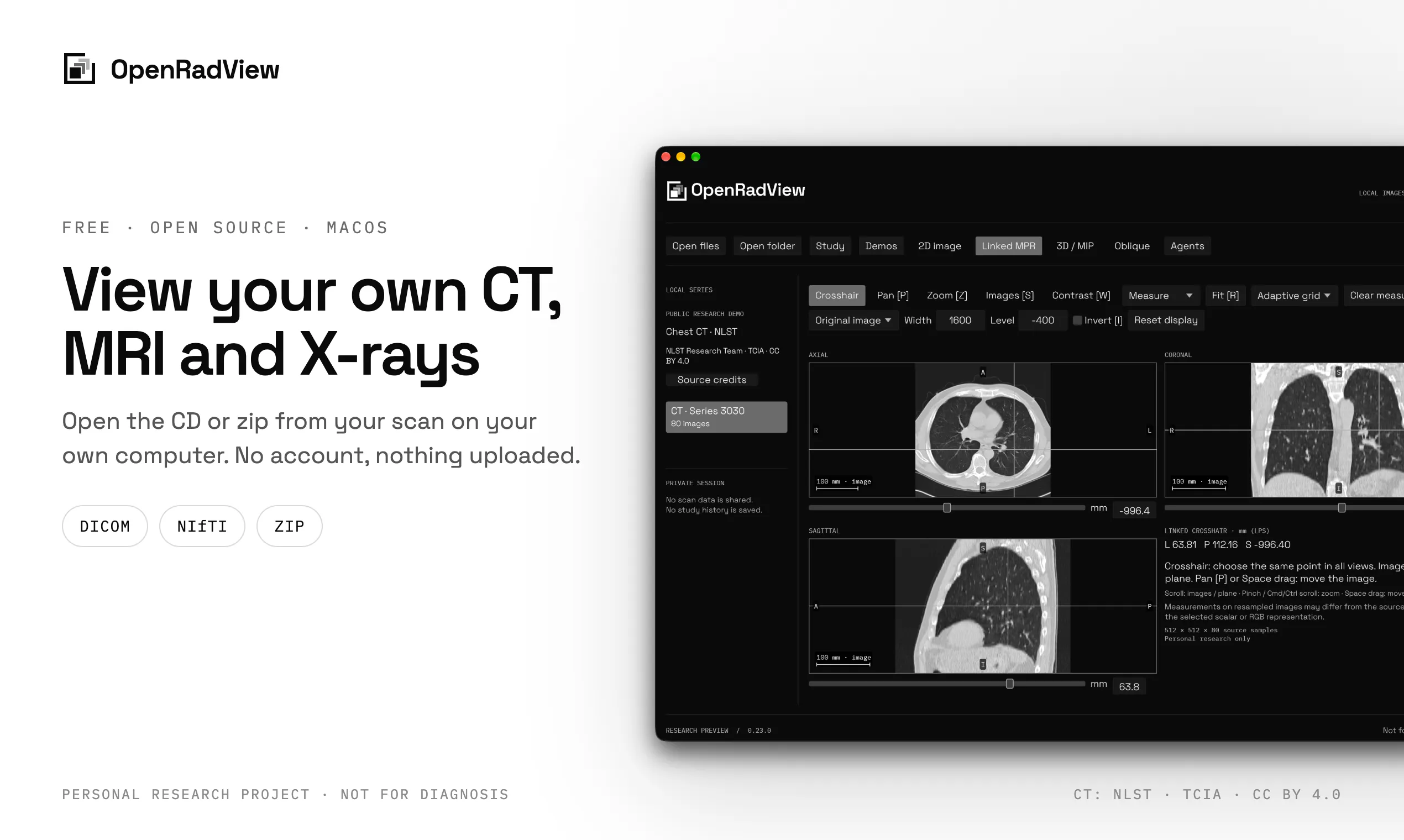 OpenRadView gallery image
