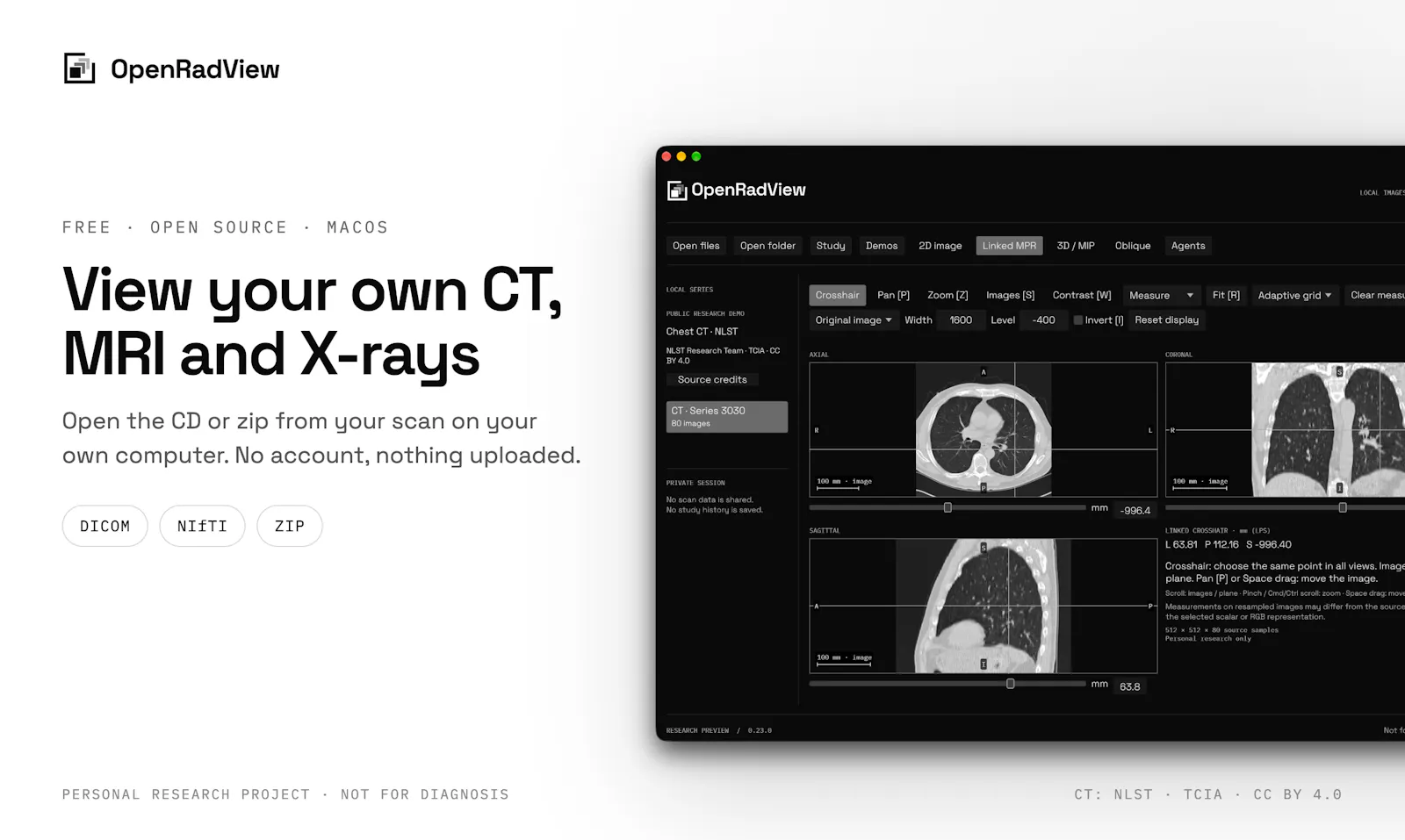 OpenRadView screenshot 1