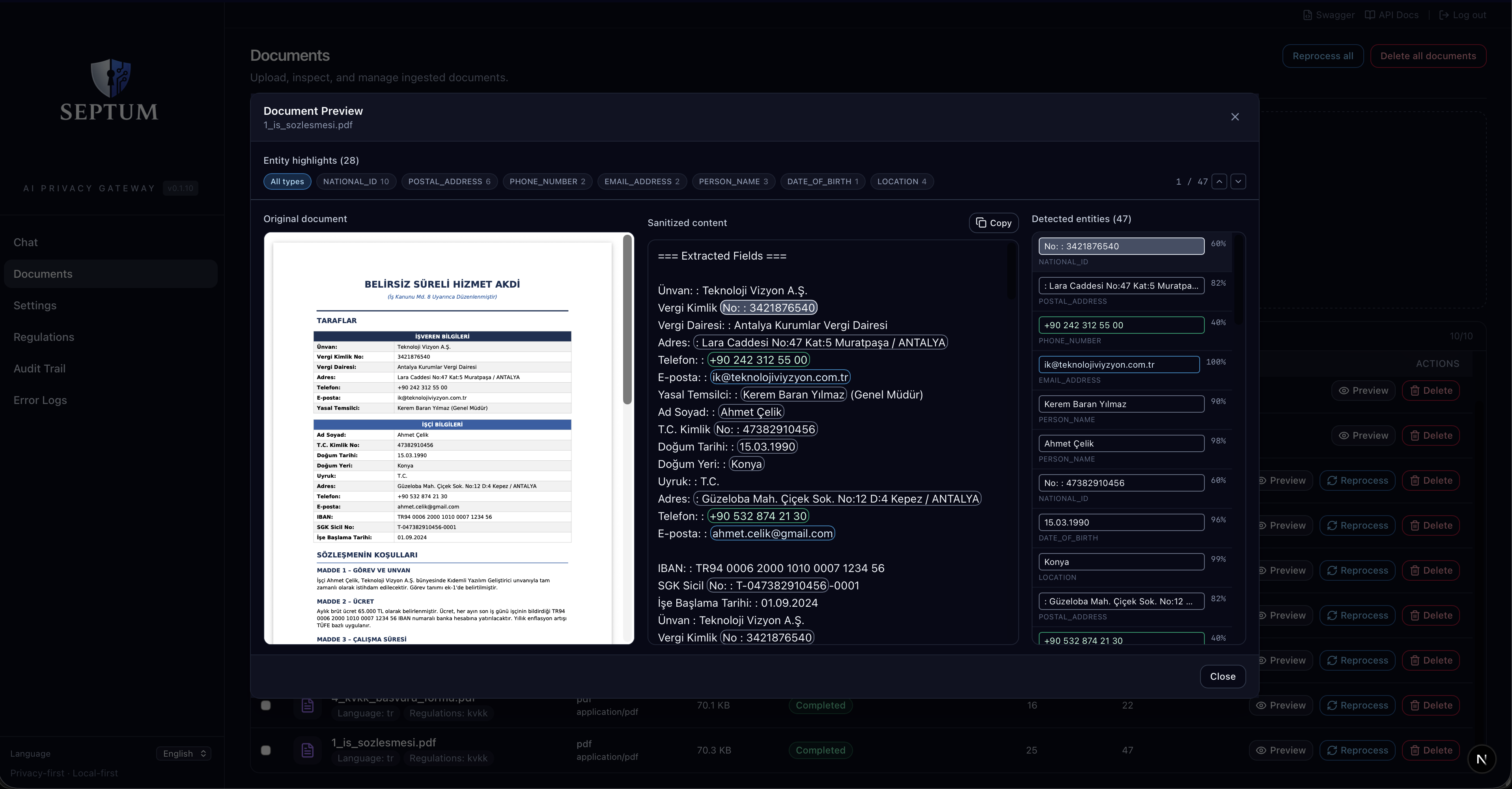 Septum gallery image