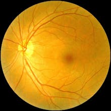 mlde Health gallery image