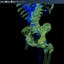3Dicom - Visualise CT/MRI Scans In 3D