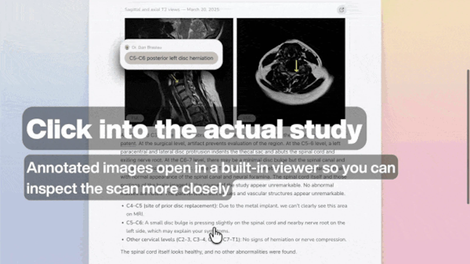 The Interactive Radiology Report screenshot 4