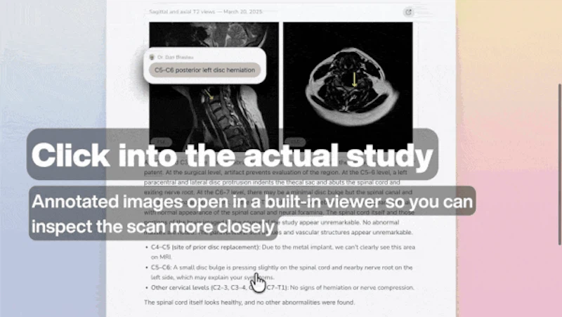 The Interactive Radiology Report screenshot 4