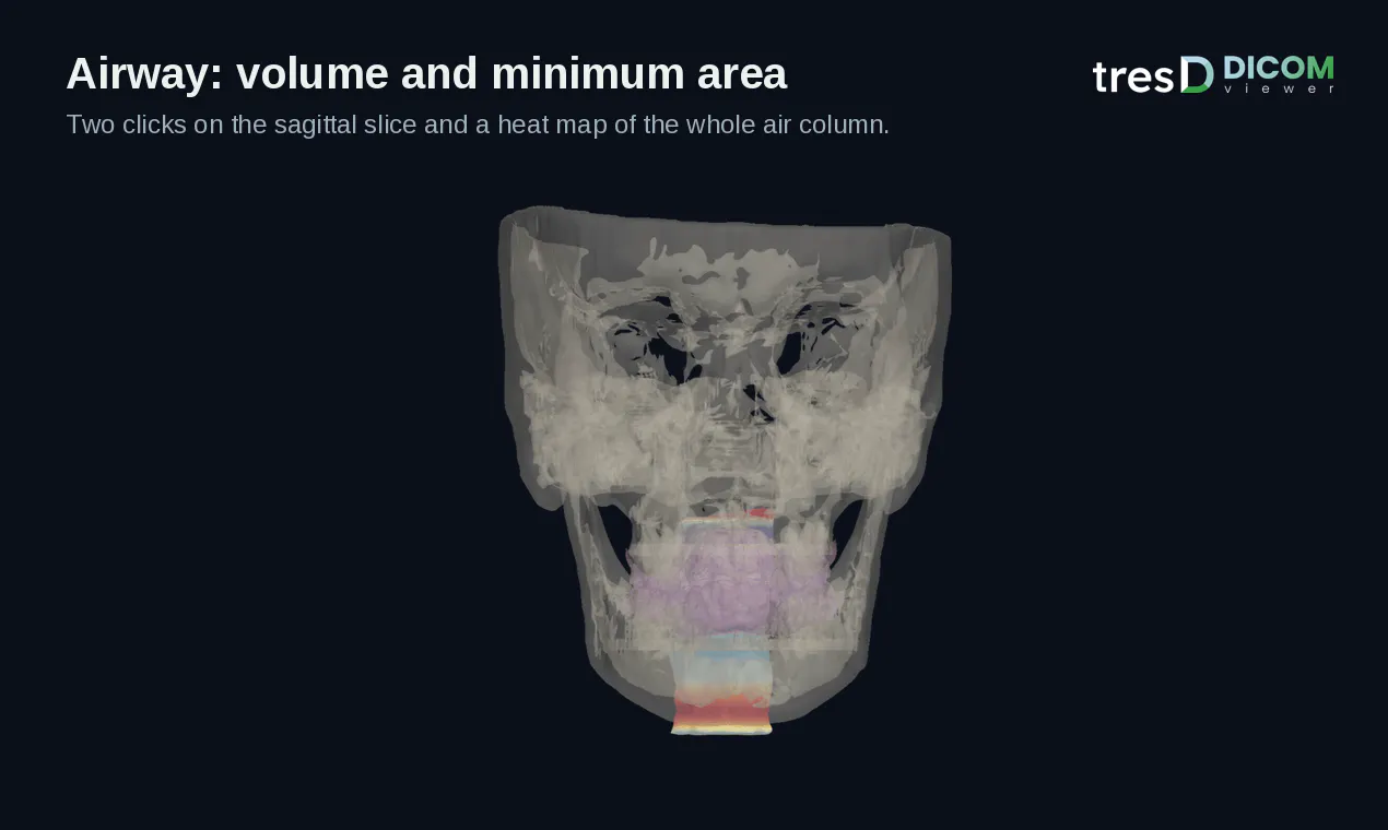 tresD DICOM gallery image