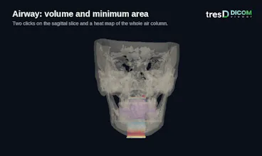 tresD DICOM gallery image