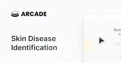 Skin Disease Identification gallery image