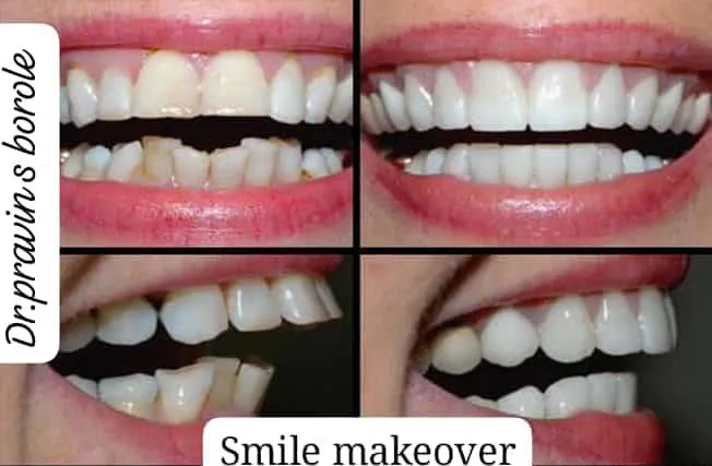 Anand Dental clinic & implant center gallery image