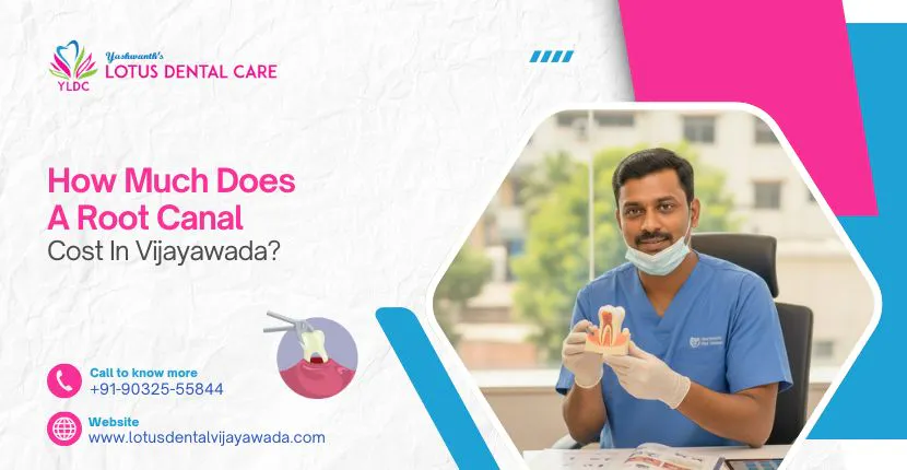 Root Canal Treatment in Vijayawada product banner