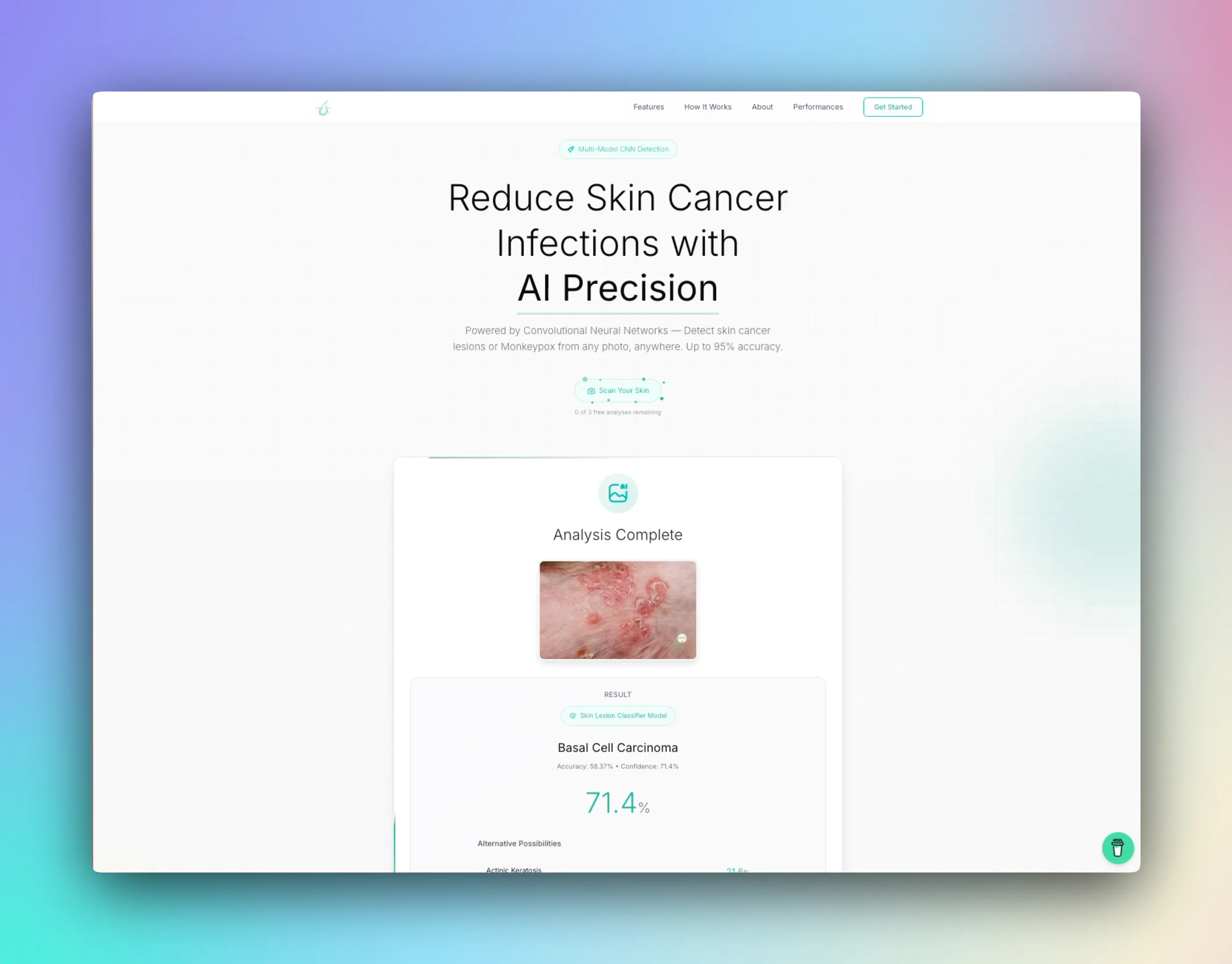 Skin Disease Identification のプロダクトバナー