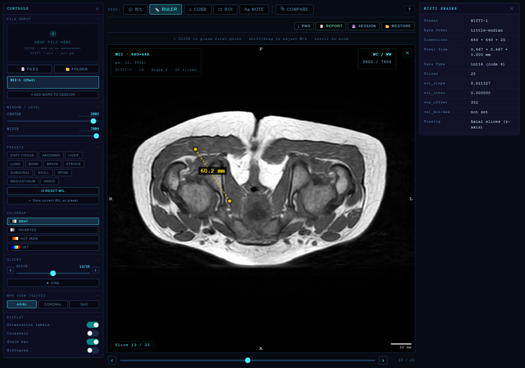 Scan Instant gallery image