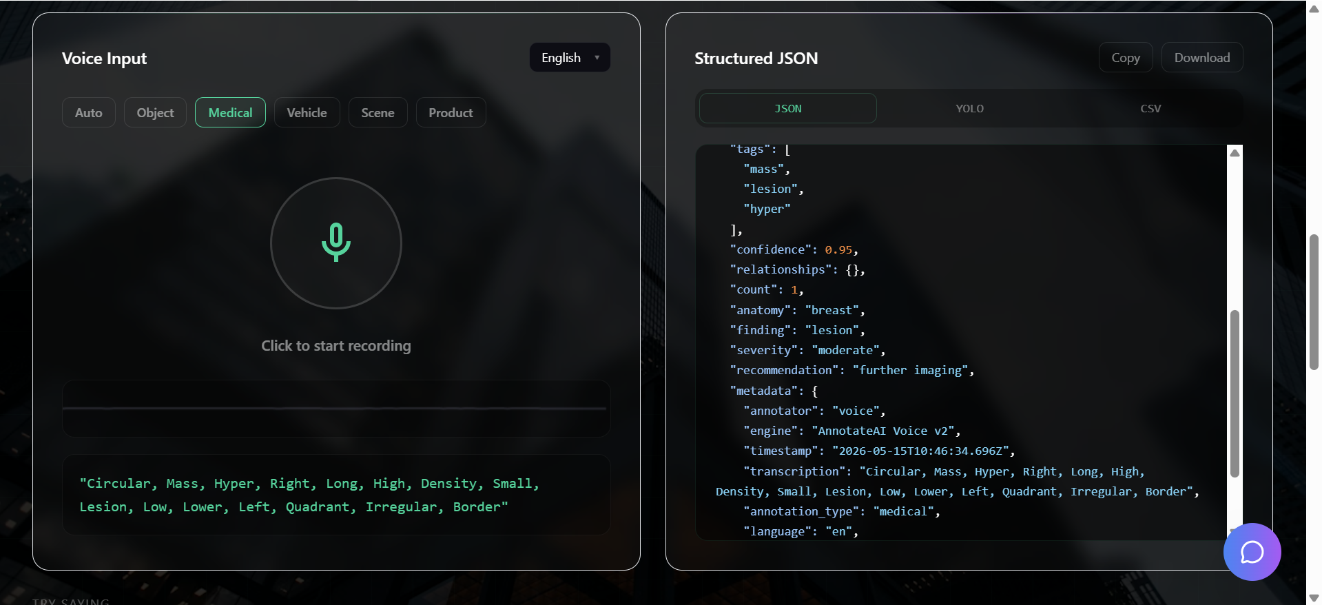 AnnotateAI gallery image