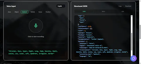 AnnotateAI gallery image