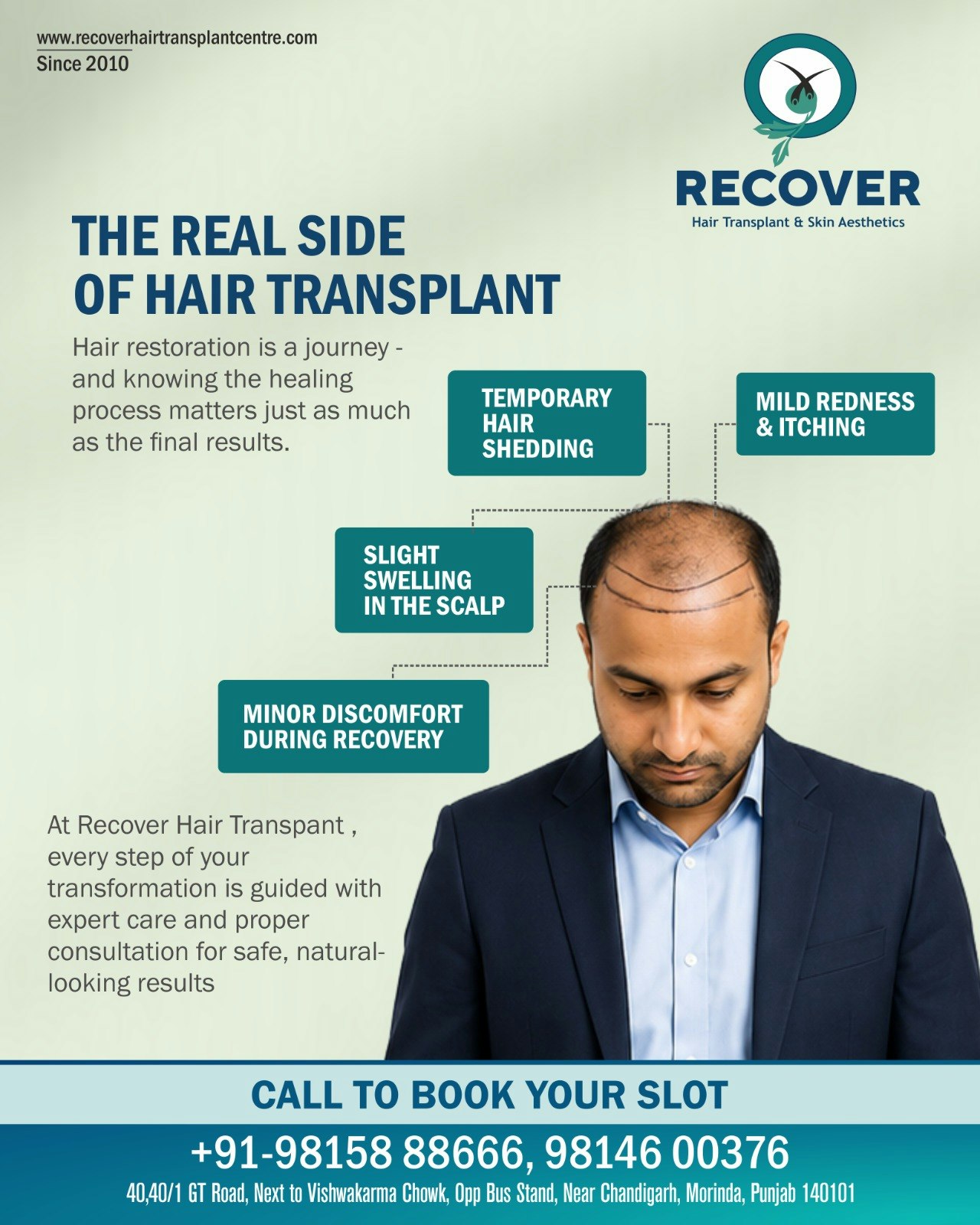  Recover Hair Transplant Centre gallery image