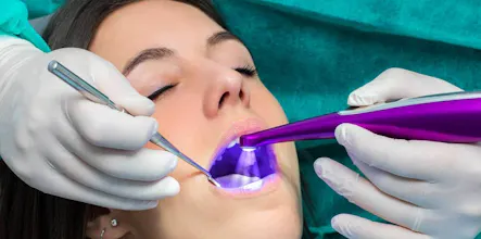 fissure sealants gallery image