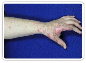 NewGel+ gallery image