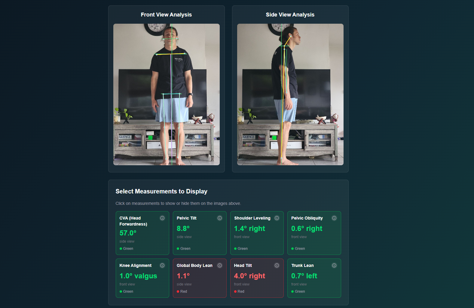 Free Posture Analysis gallery image