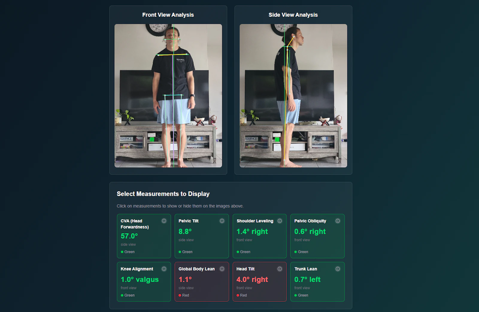 Free Posture Analysis screenshot 2