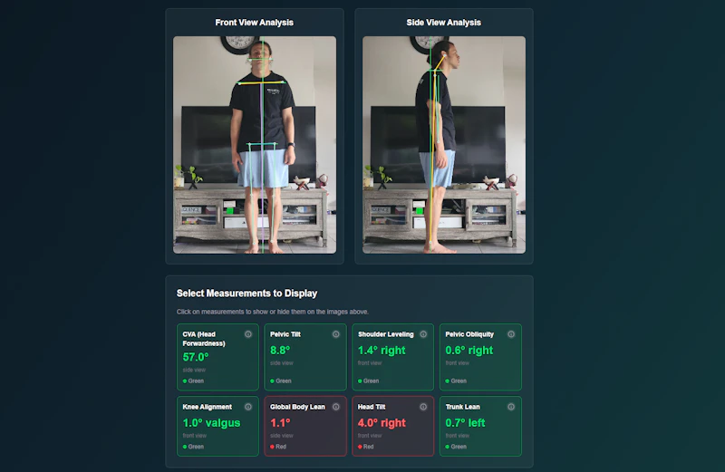 Free Posture Analysis screenshot 2